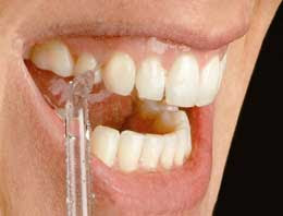 WaterPik versus Floss Miami FL